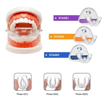 Стоматологические Ортодонтические Брекеты Прибор для тренировки зубов для взрослых Фиксатор для защиты полости рта Зубной лоток Синий Фиолетовый Мягкий и твердый